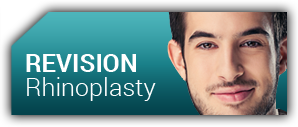Revision Rhinoplasty in Baltimore, MD